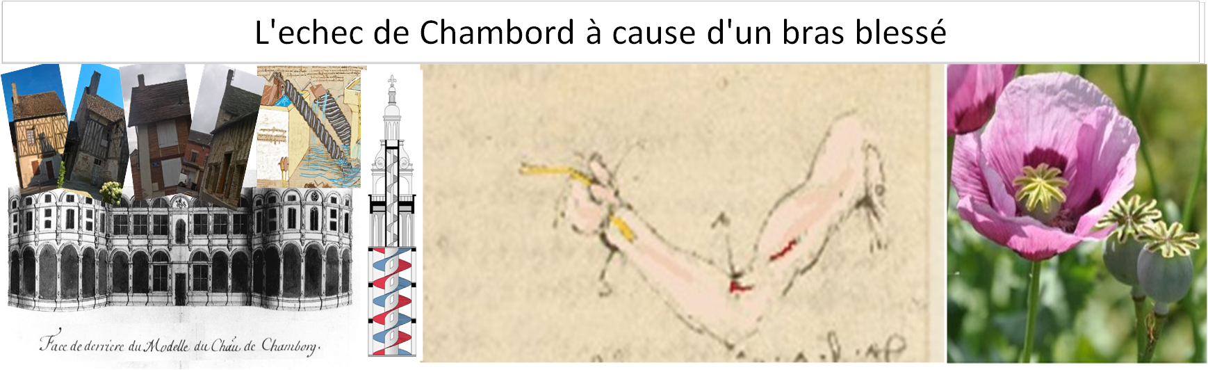 L'échec de Chambord à cause d'un bras blessé